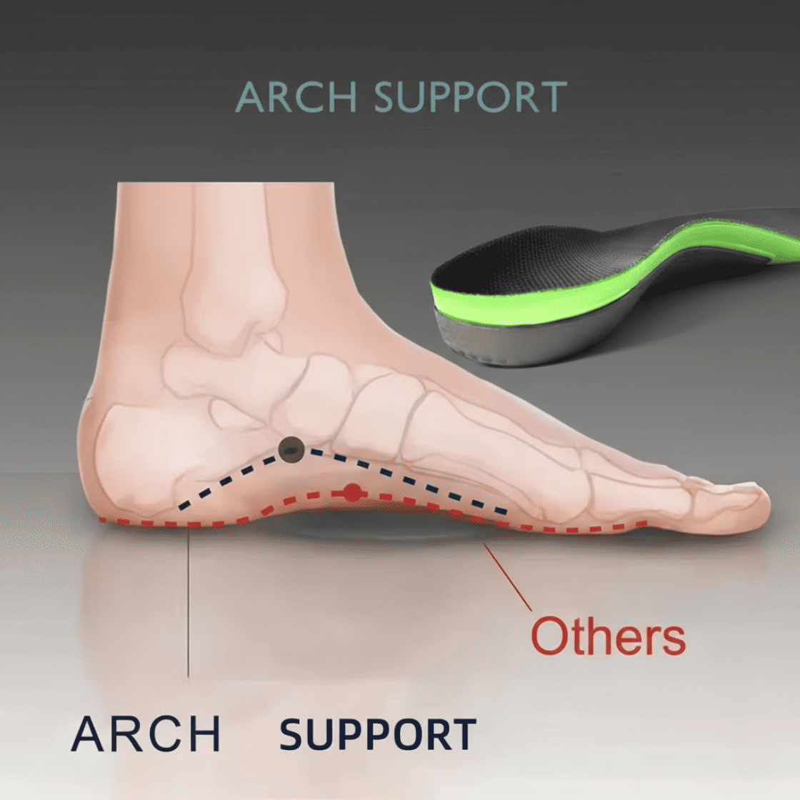 HzN Orthopedic Insoles 1.0